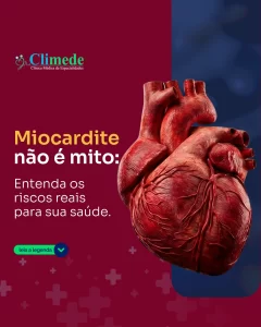 MIOCARDITE